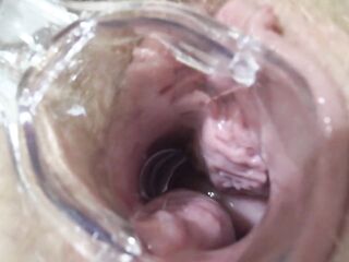 Mature lesbians play in a gynecologist, open the vagina with a medical dilator, examine the cervix.