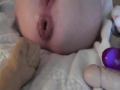 Wild and rough anal fisting with a massive prolapse