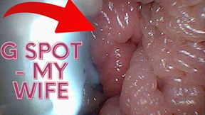 Visual Guide to G-Spot Stimulation and Orgasm - Endoscopic Perspective